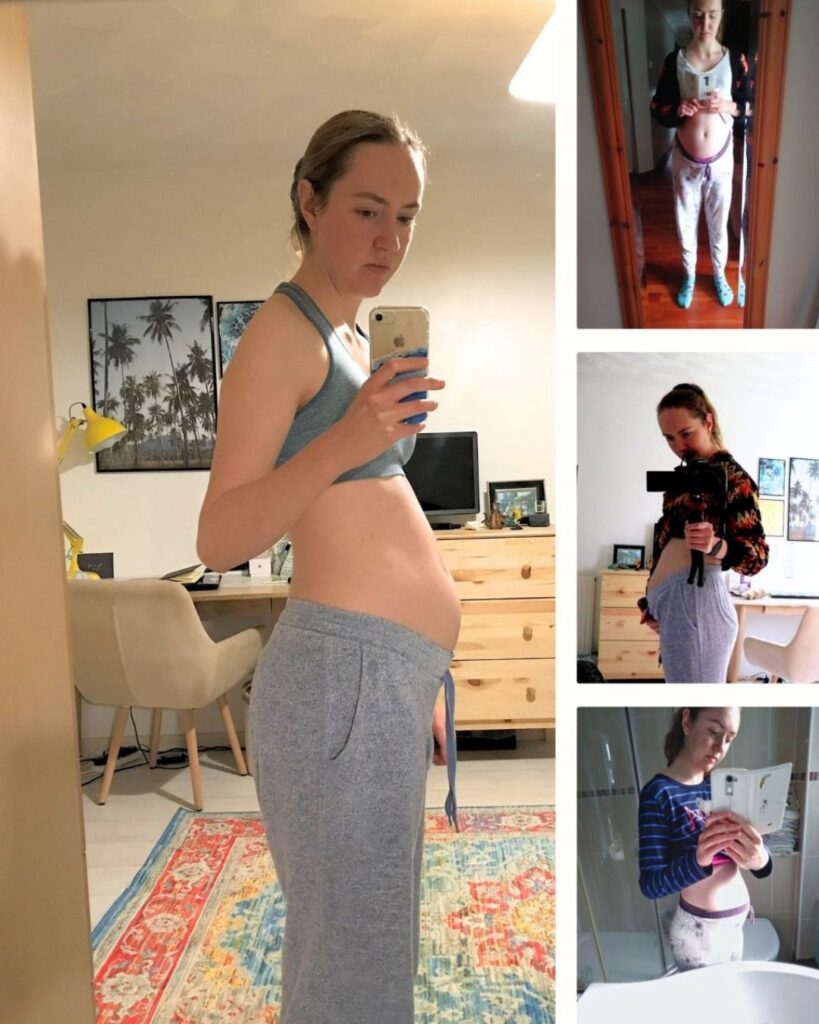 IBS nutritionist
