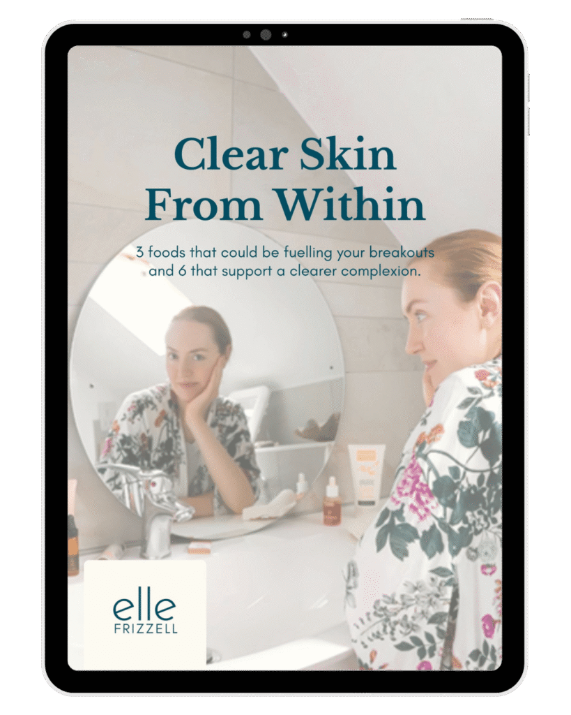 Nutrition tips to reduce breakouts and acne