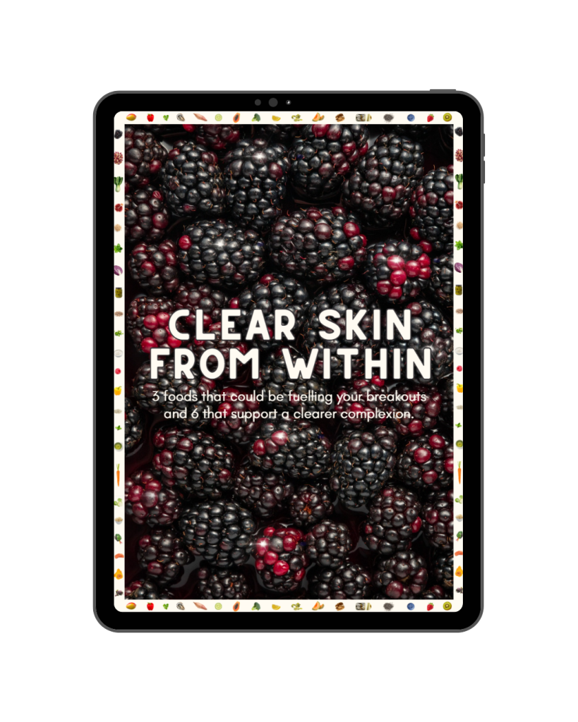 nutritional therapy for acne