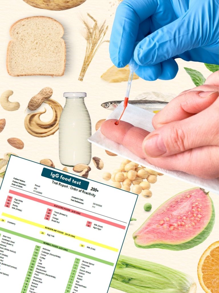 IgG food test